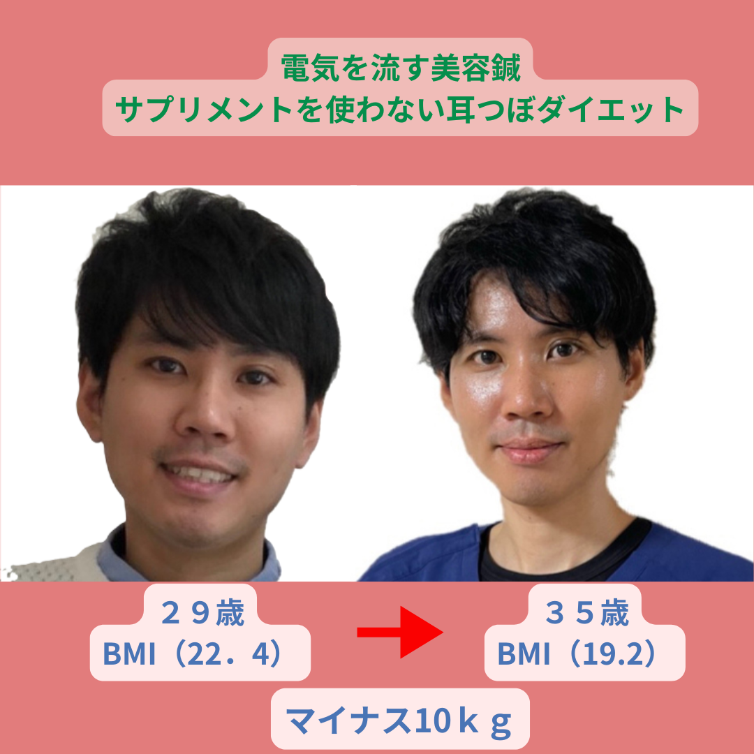 耳つぼダイエットのビフォーアフター例